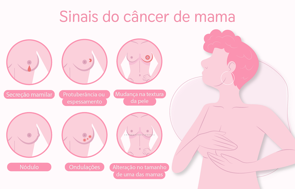 câncer de mama sinais e sintomas