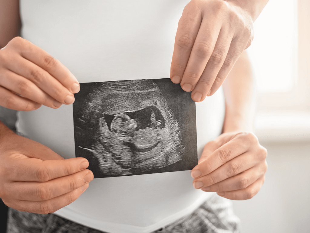 Dra-Karina-Belickas-GINECOLOGISTA-obstetra-porque-fazer-pre-natal-casal-com-ultrassom